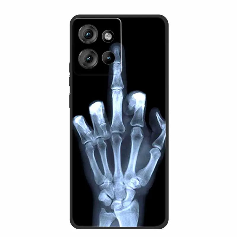 For Motorola G 2025 Case Coque Soft TPU Silicone Phone Cases For Motorola Moto G 2025 Back Cover Case 6.7" Shockproof Funda Para